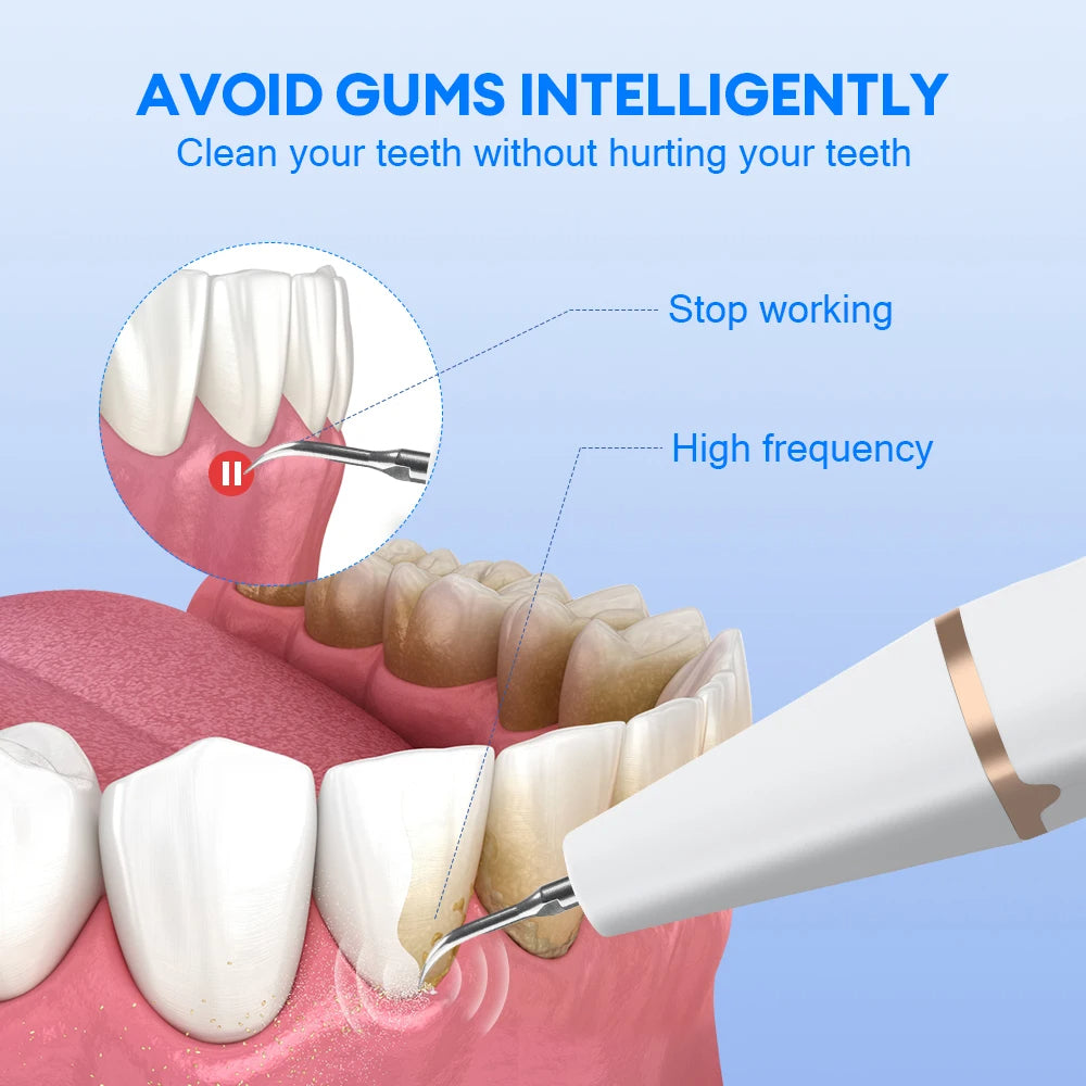 Dental Scaler with Advanced Safety Feature that Automatically Stops Operating upon Gum Contact to Protect Oral Health.