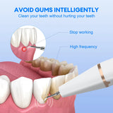 Dental Scaler with Advanced Safety Feature that Automatically Stops Operating upon Gum Contact to Protect Oral Health.