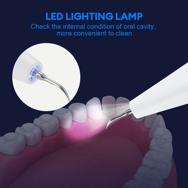 Dental Scaler featuring an Integrated LED Light for Enhanced Visibility within the Oral Cavity during Cleaning Processes.